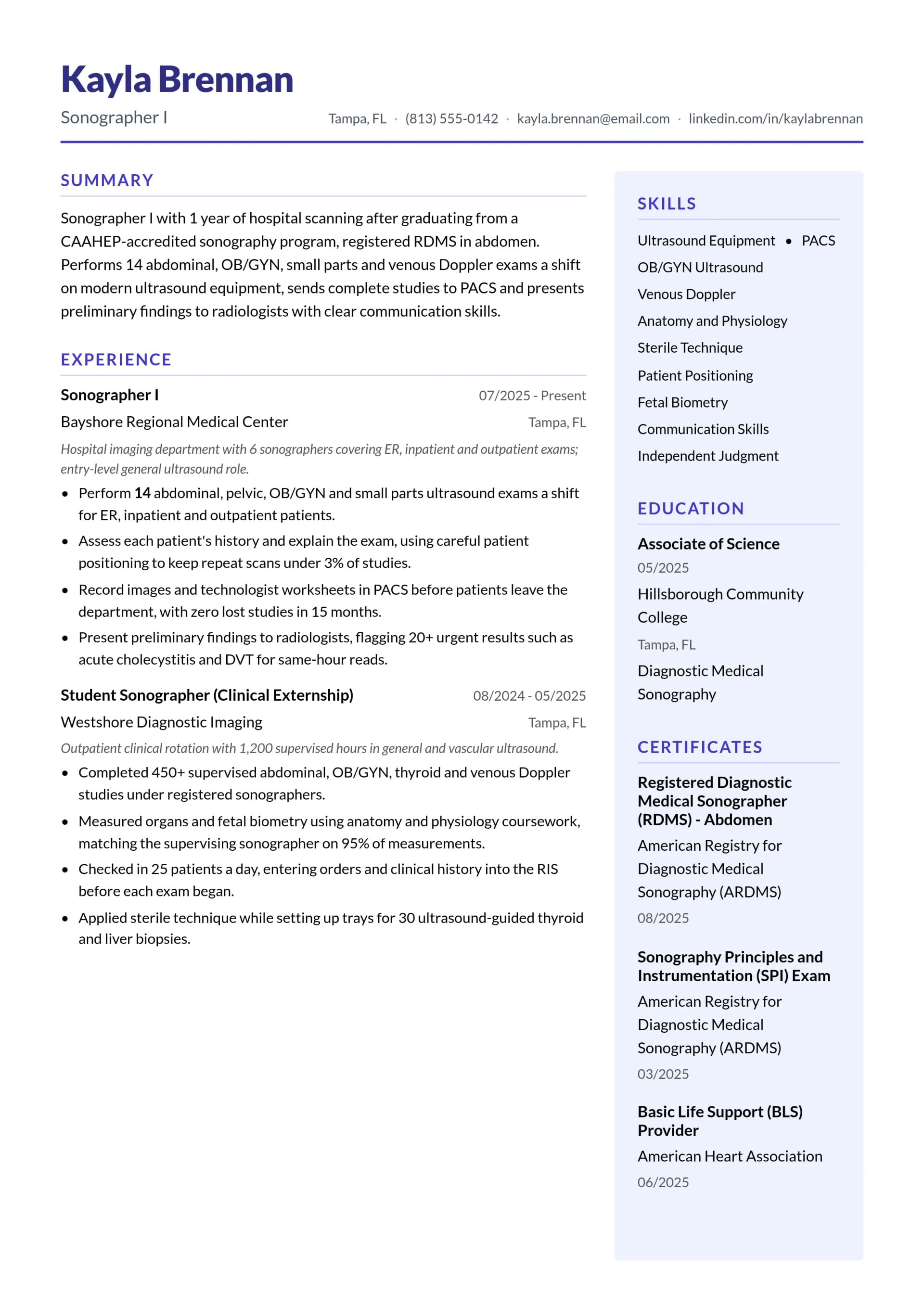 Sonographer I resume example