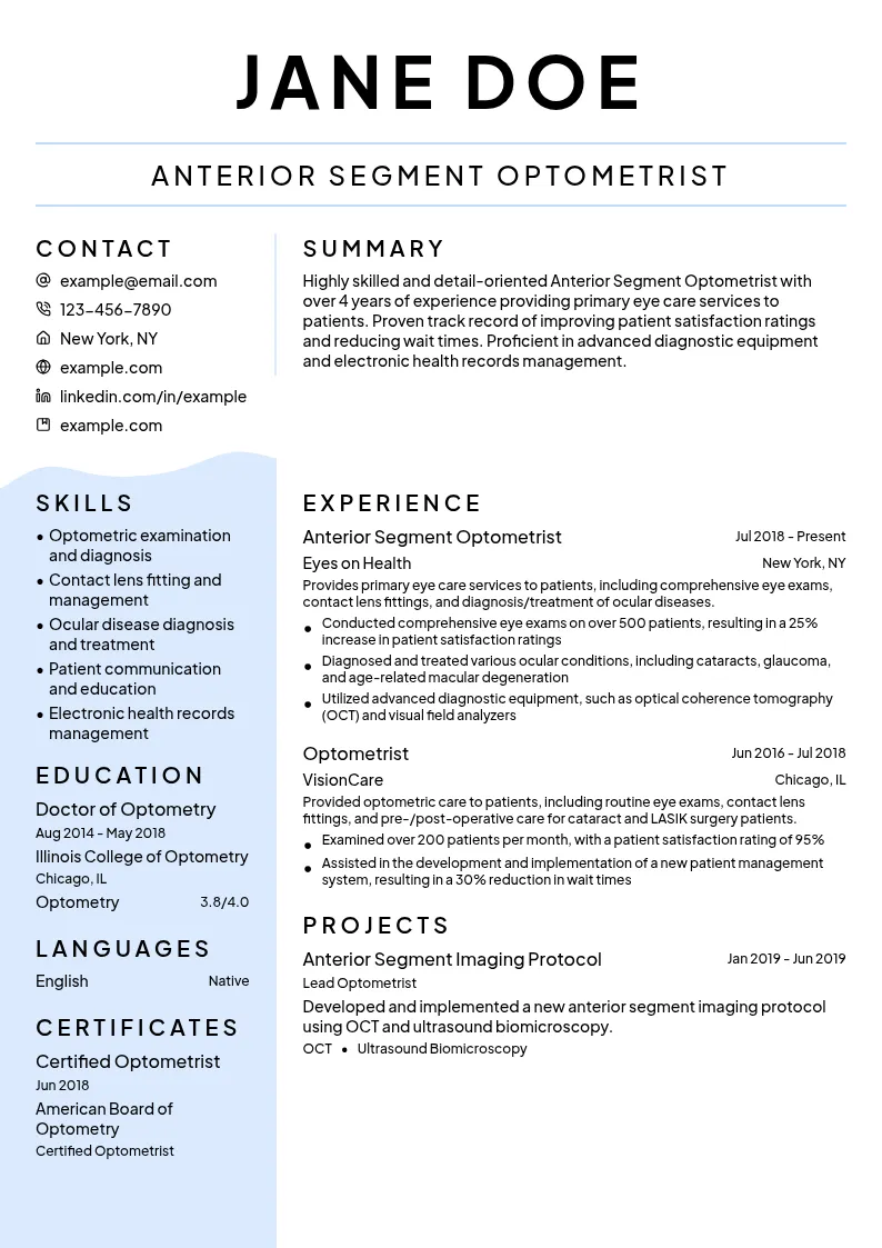 Anterior Segment Optometrist resume example